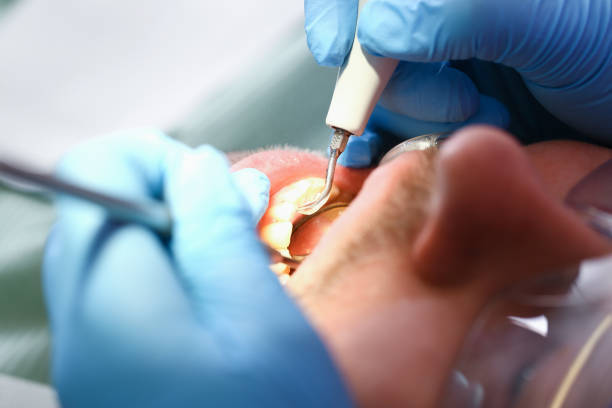 Best Tooth Pain Emergency Relief  in Uhrichsville, OH